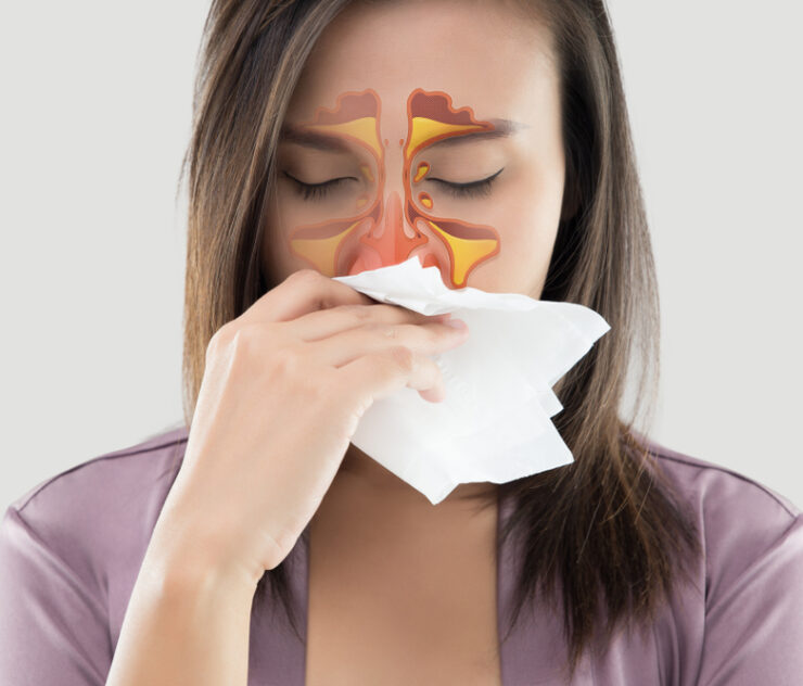 Do I Need a Sinus Infection Specialist in McLean Virginia?