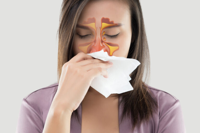 Do I Need a Sinus Infection Specialist in McLean Virginia?