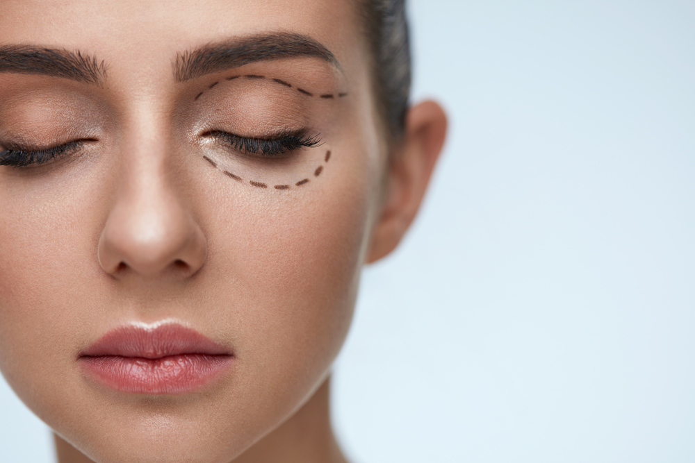 Eyelid Surgery McLean Virginia