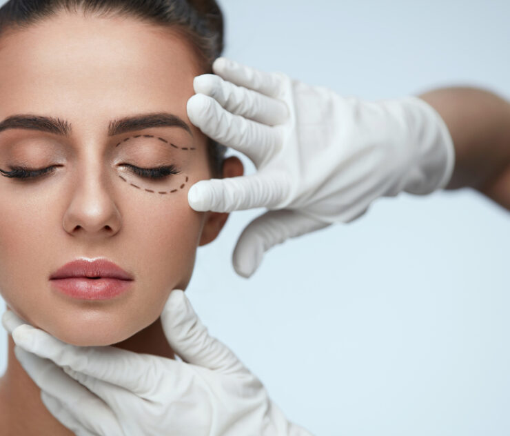 Eyelid Surgery