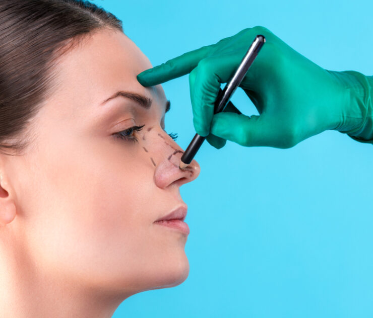 Best Rhinoplasty Surgeon in DMV