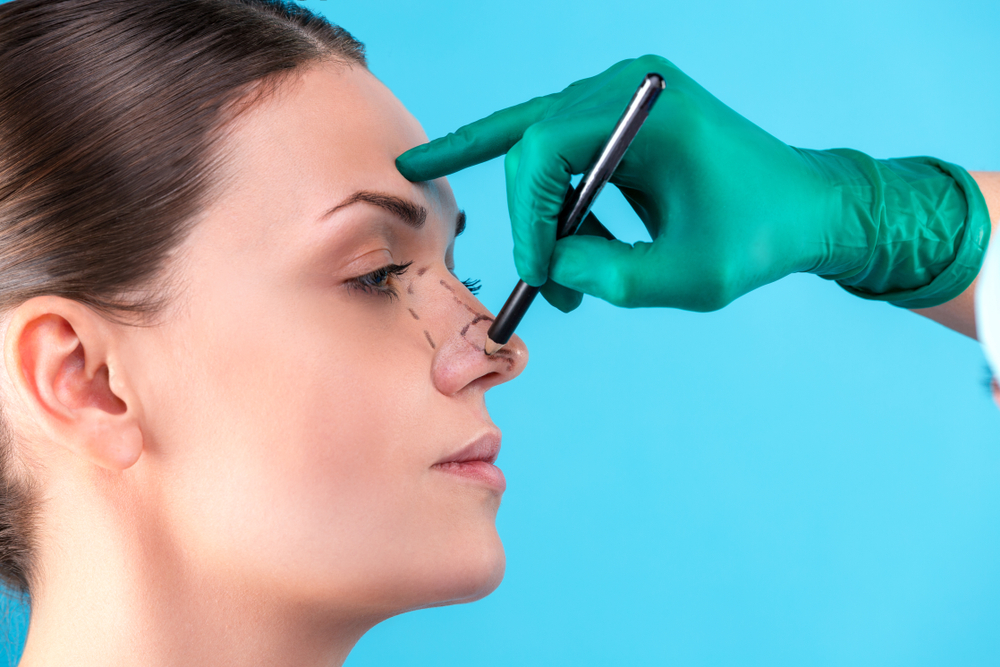 Best Rhinoplasty Surgeon in DMV