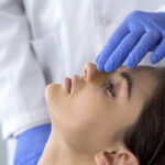 Revision Rhinoplasty Specialist in McLean