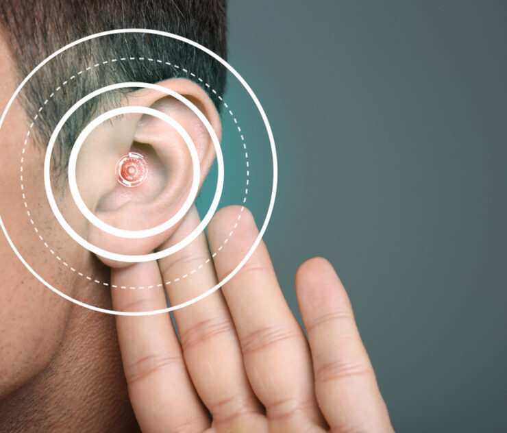 4 Reasons You Need a Hearing Aid Consultation in West Springfield, Virginia