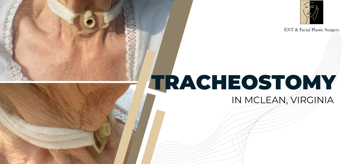 Tracheostomy