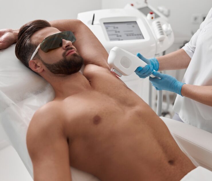 Are Permanent Laser Hair Removal Results in Vienna, VA Actually Forever?