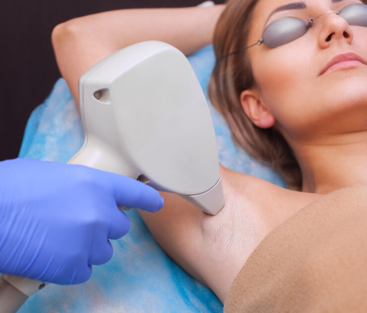 Is Permanent Laser Hair Removal in McLean VA Possible?