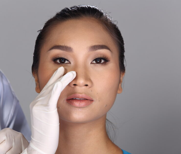 How to Get the Best Ethnic Rhinoplasty in Washington DC