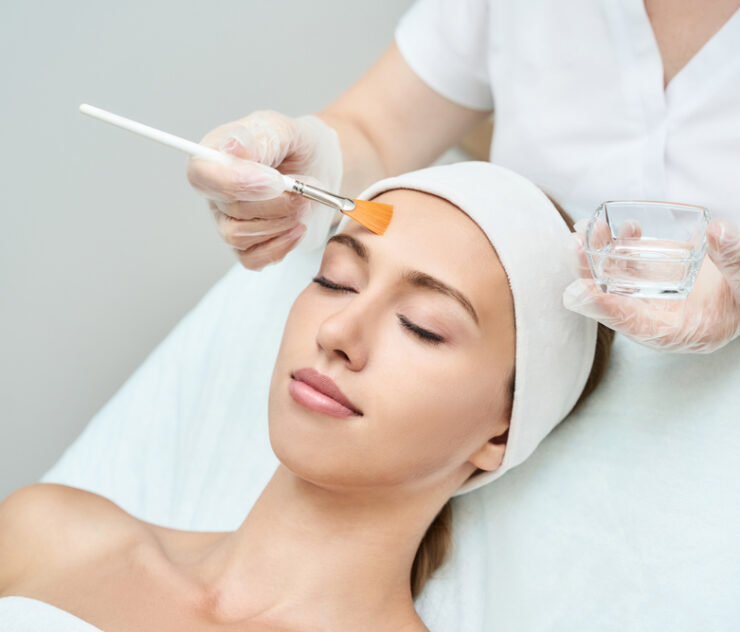 Best Chemical Peels for Acne in McLean