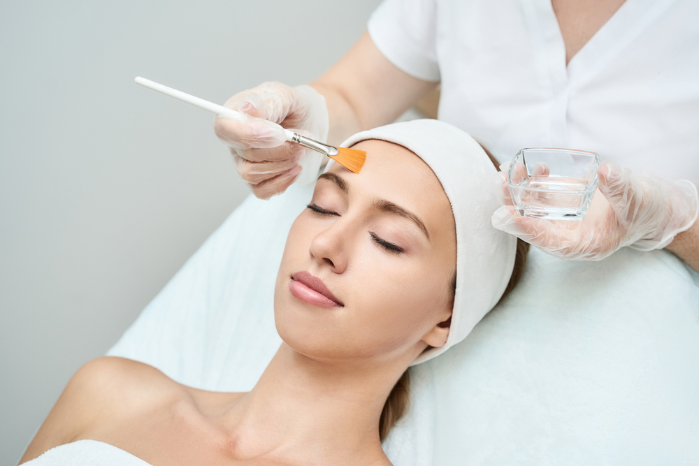 Best Chemical Peels for Acne in McLean