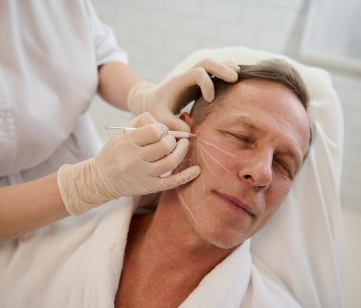 How Much Downtime Should I Expect From a Facelift?