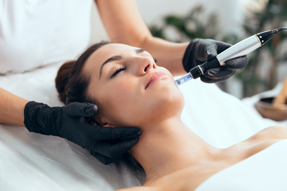 Microneedling in Northern Virginia