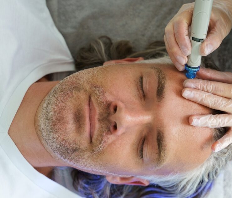 How Much Does the HydraFacial Cost in Tysons Corner Virginia?