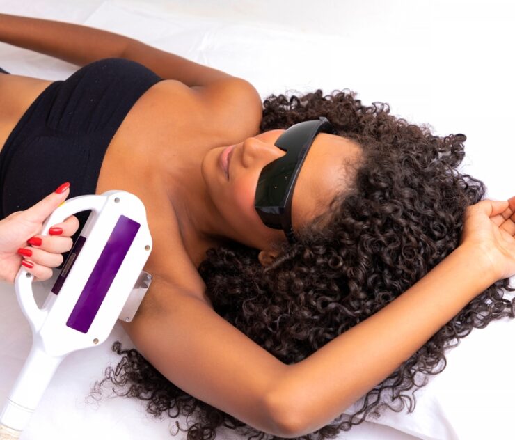 Best Laser Hair Removal for Dark Skin Types in Merrifield