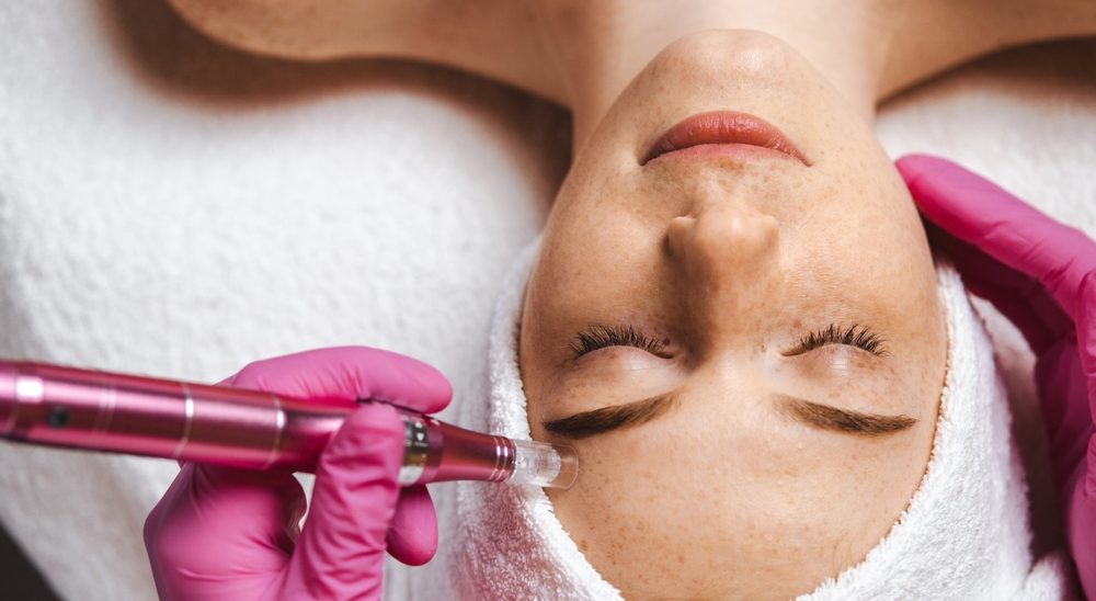 How Painful Is Microneedling and How Long Do Results Last?