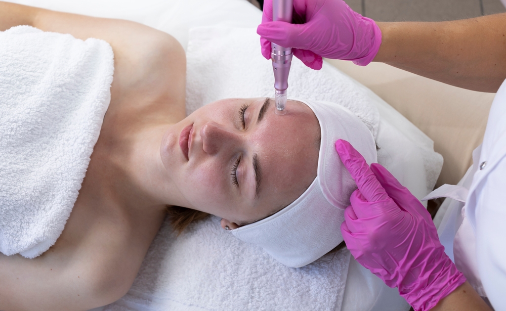 How Much Does the Best PRP Microneedling Cost