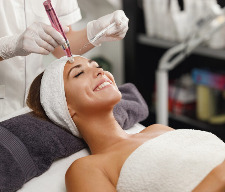 5 Quick Tips for the Best Microneedling Results in McLean
