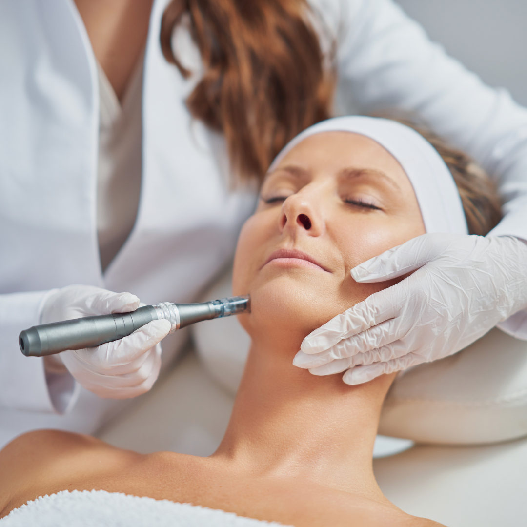 Microneedling Treatments McLean Virginia