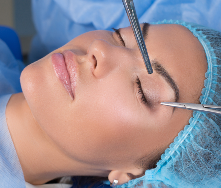 How Long Does Eyelid Surgery Really Last?