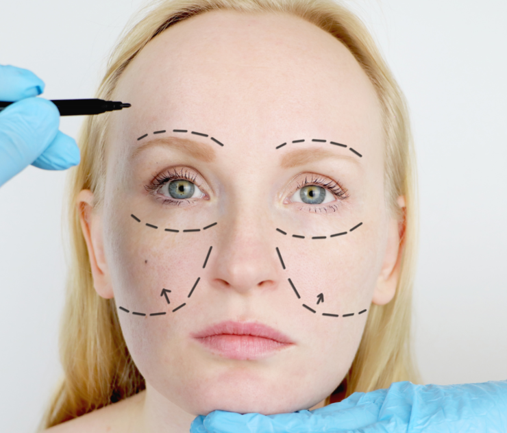 How to Choose the Best Facial Plastic Surgeon for Me?