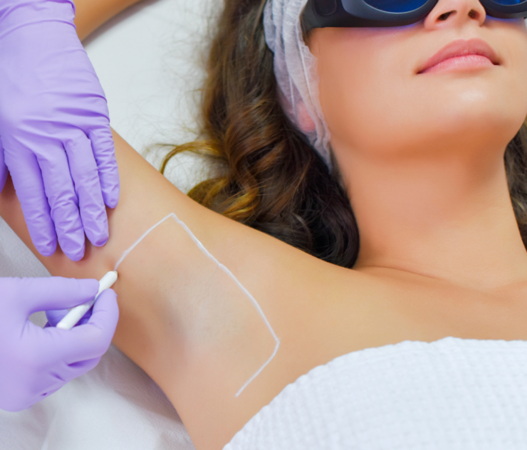 Laser hair Removal Specialist in Vienna Virginia