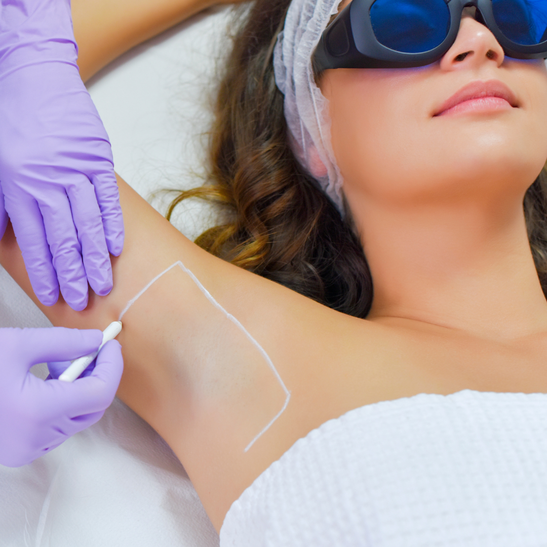 Laser hair Removal Specialist in Vienna Virginia