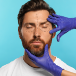 Eyelid surgery cost near Vienna Virginia