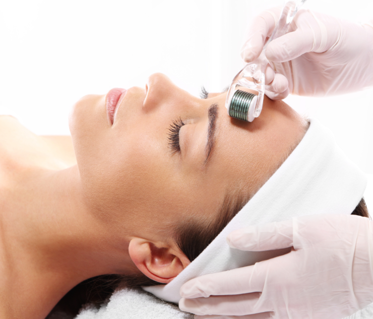 Microneedling Cost in Falls Church Virginia