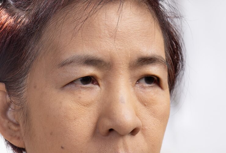 Unfortunately, there is no cure, but the condition can be managed with the best allergy and sinus specialist in Fairfax. 