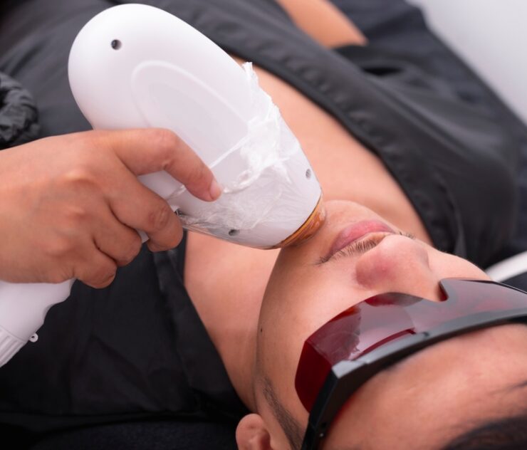 The Truth About Painless Laser Hair Removal in Vienna