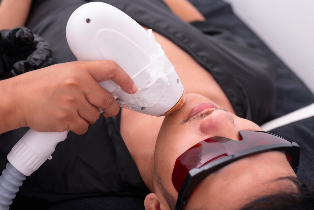 The Truth About Painless Laser Hair Removal in Vienna