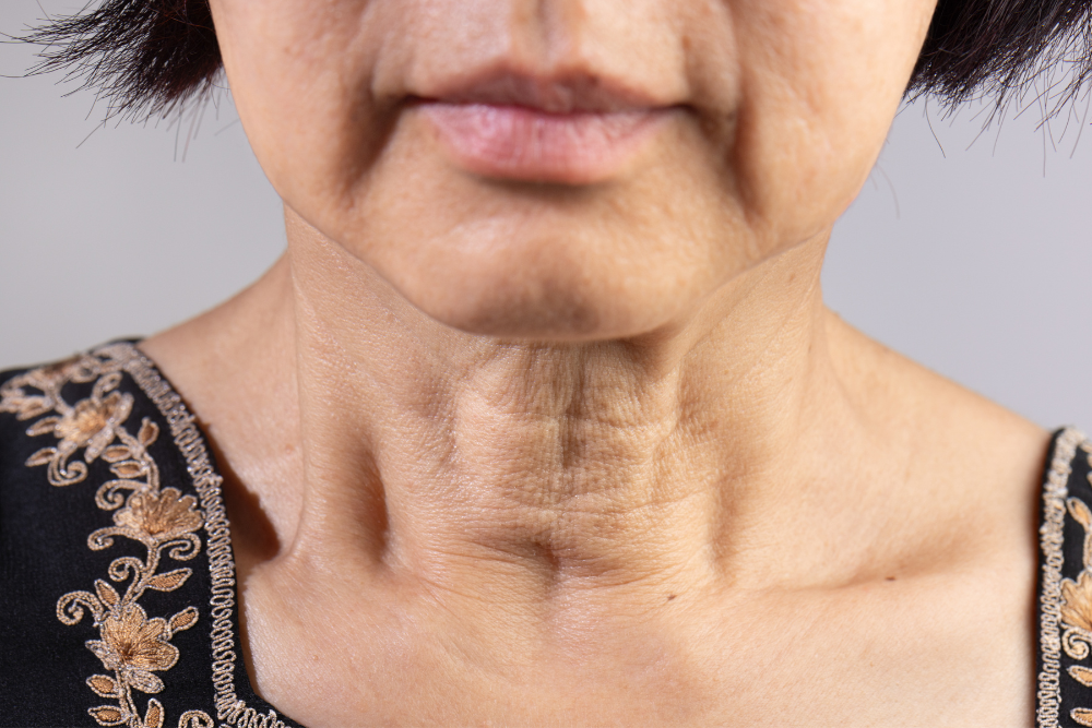 Advanced Neck Lift Procedures in Purcellville, VA