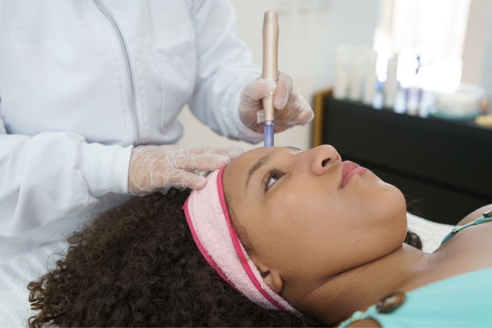 Microneedling Benefits in McLean, Virginia for Radiant Skin