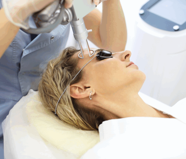 Laser Resurfacing Cost in Vienna, Virginia