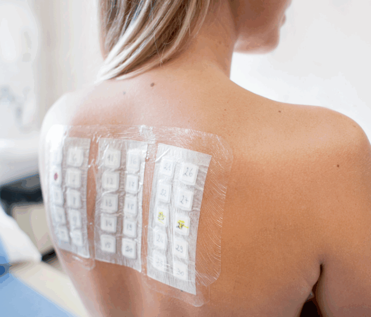 Allergy Testing and Treatment in McLean and Northern Virginia ENT Clinics