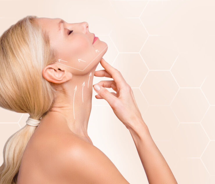 How to Find the Top Neck Lift Surgeons Near Sterling, Virginia