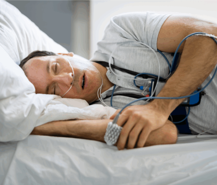 Is Sleep Apnea Testing Covered by Insurance in Virginia?
