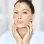 Anti-Aging Chemical Peels in McLean, VA
