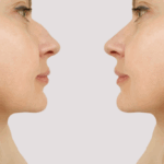 Best Rhinoplasty Clinics in South Riding, VA for Natural-Looking Results