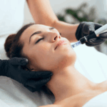 Loudoun County, VA Guide to Collagen Induction Therapy