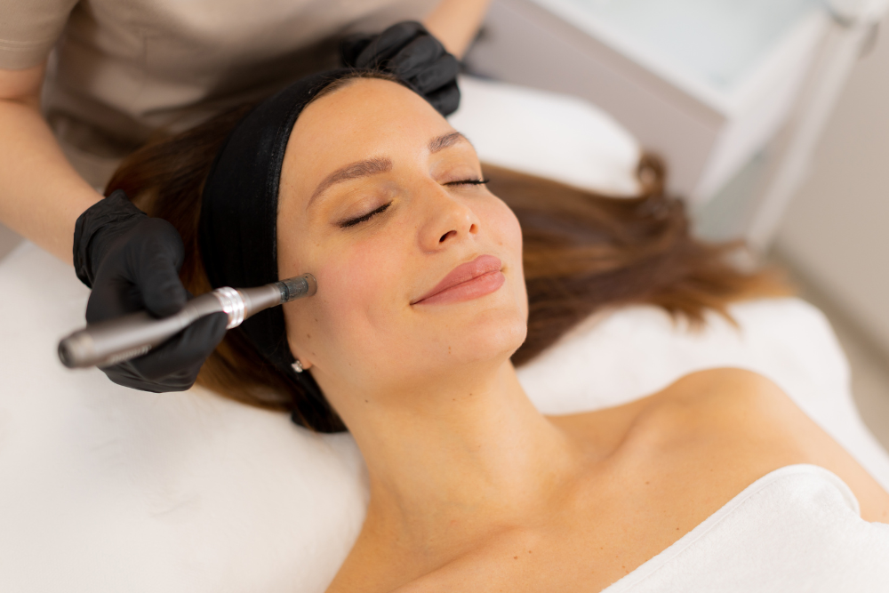 Microneedling Prices in Vienna, VA