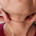 Average Neck Lift Cost in Leesburg, VA