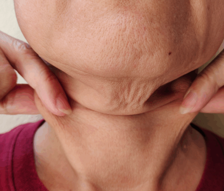 Average Neck Lift Cost in Leesburg, VA