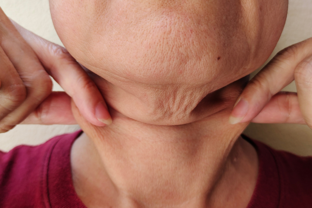 Average Neck Lift Cost in Leesburg, VA