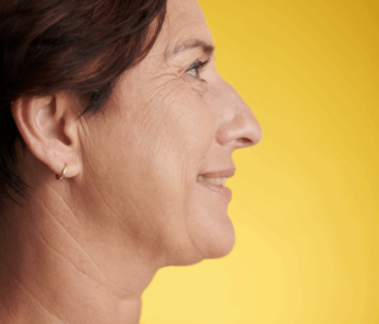 Neck Lift Expenses in Northern VA: Leesburg to Ashburn