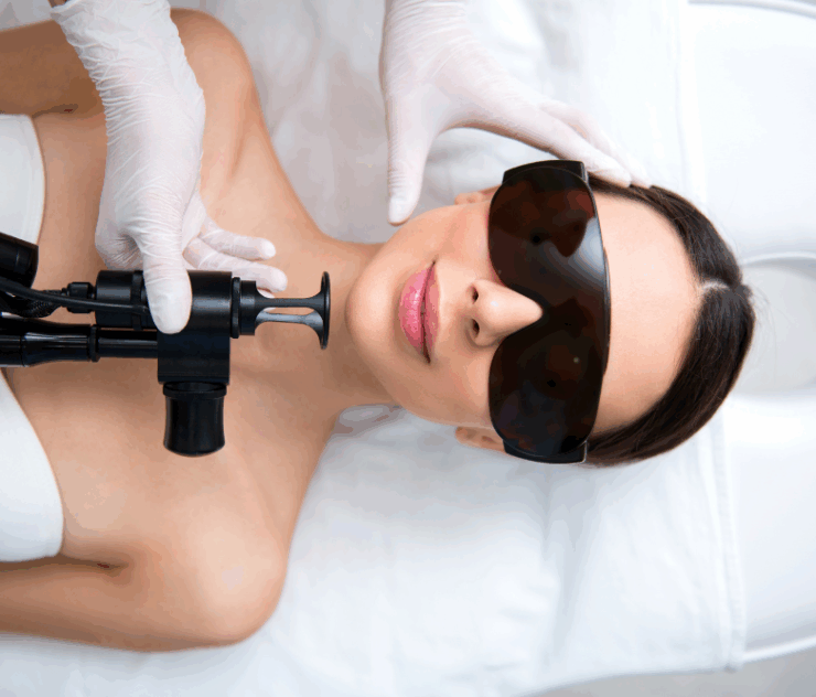 Top Laser Resurfacing Treatment in McLean, VA