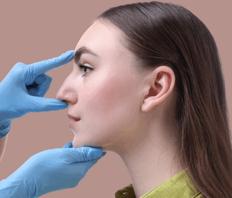 Rhinoplasty Tip Refinement and Bump Reduction Near Ashburn