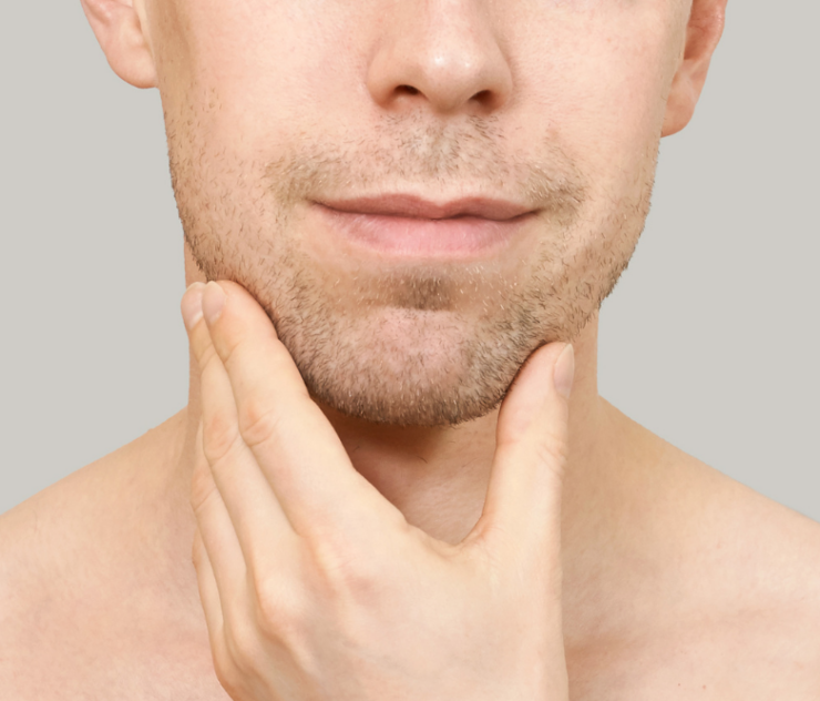 Chin Augmentation and Jawline Enhancement Appointments in Loudoun County, VA