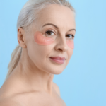 Eyelid Rejuvenation and Under Eye Bag Removal Consult Near Lovettsville, Virginia