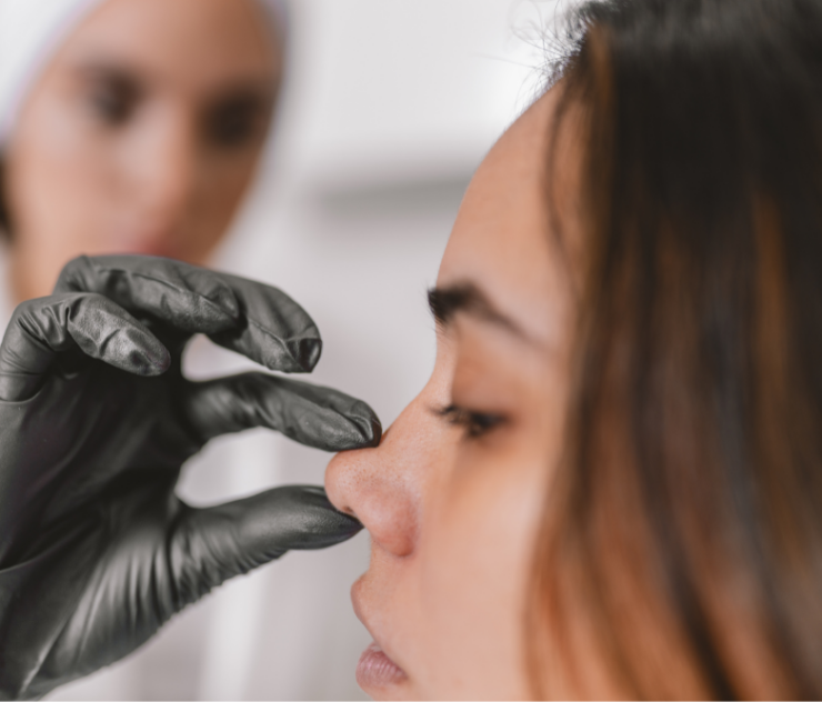 Revision Rhinoplasty Consultation and Pricing Near Lansdowne, Virginia